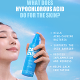 Person holding a blue lapcos bottle with text about hypochlorous acid spray benefits for skin : kills acne-causing bacteria, supports skin barrier, reduces inflammation, helps calm irritation.