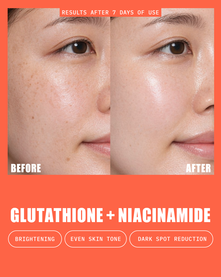 Before and after skin comparison using glutathione and niacinamide with phrases "brightening" "even skin tone" and "dark spot reduction"