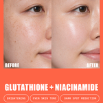 Before and after skin comparison using glutathione and niacinamide with phrases "brightening" "even skin tone" and "dark spot reduction"