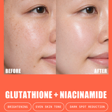 Before and after skin comparison using glutathione and niacinamide with phrases "brightening" "even skin tone" and "dark spot reduction"